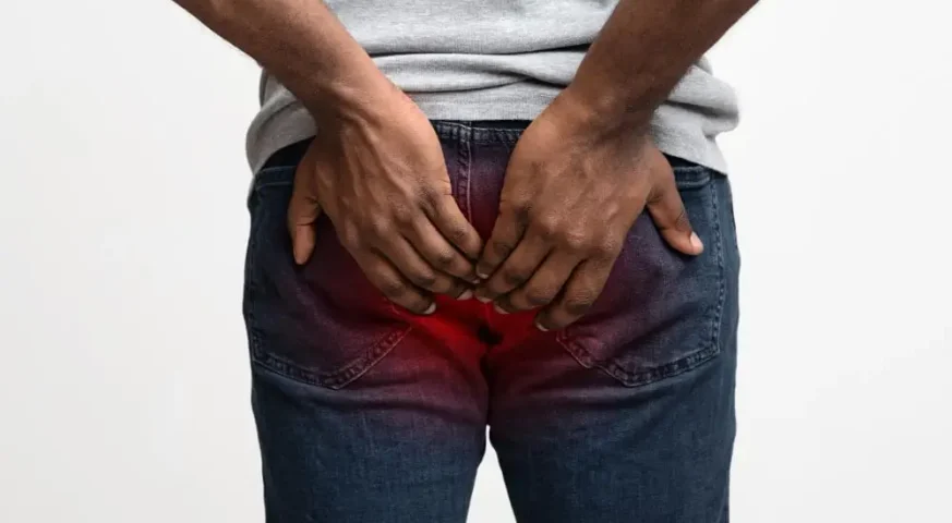 عملية الناسور بدون الم جراحة الناسور بدون الم اعراض الناسور