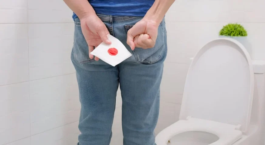 اعراض الناسور الشرجي علاج الناسور في عمان