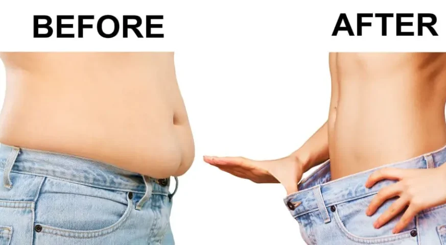 سعر عملية تكميم المعدة في عمان الاردن تكلفة عملية تكميم المعدة في عمان افضل دكتور تكميم في الاردن عملية تكميم المعدة في الاردن