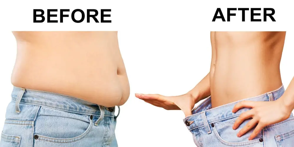 سعر عملية تكميم المعدة في عمان الاردن تكلفة عملية تكميم المعدة في عمان افضل دكتور تكميم في الاردن عملية تكميم المعدة في الاردن