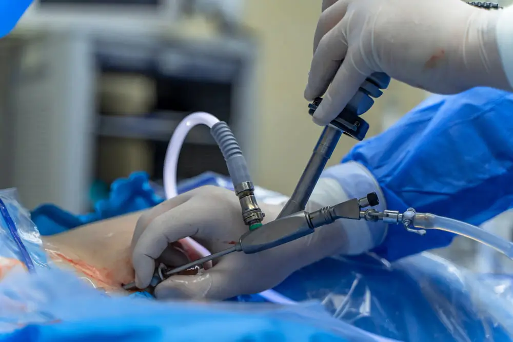 جراحة بالمنظار ضمن دليل اسئلة عن جراحة المنظار في الاردن